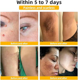 Zidella Skin Lighting Blemish Cream 50g